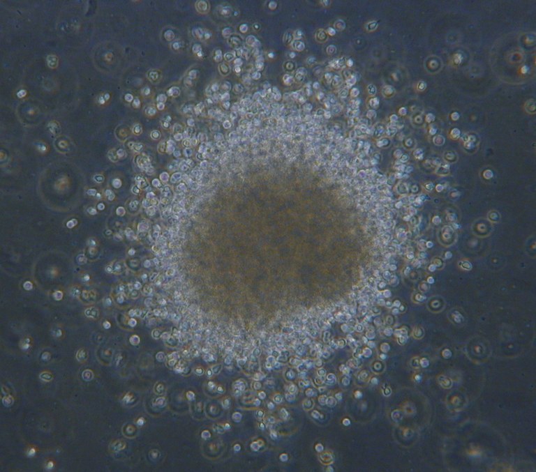 obr.1. Kolonie CFU GM in vitro