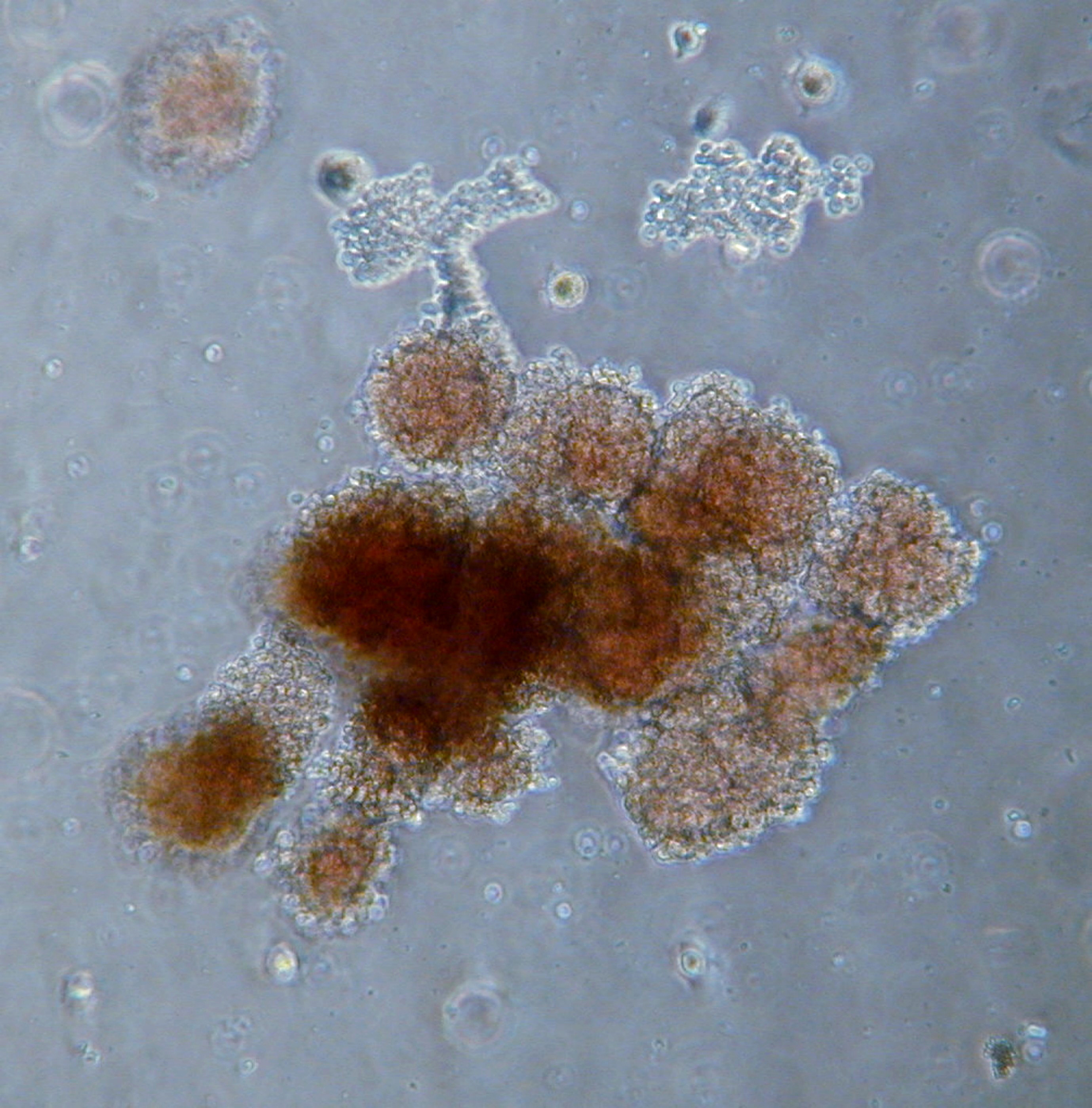 obr.2. Kolonie BFU E in vitro